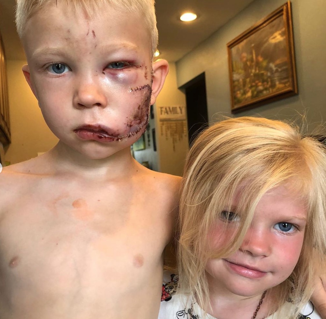 Brother Stops Dog From Attacking Little Sister